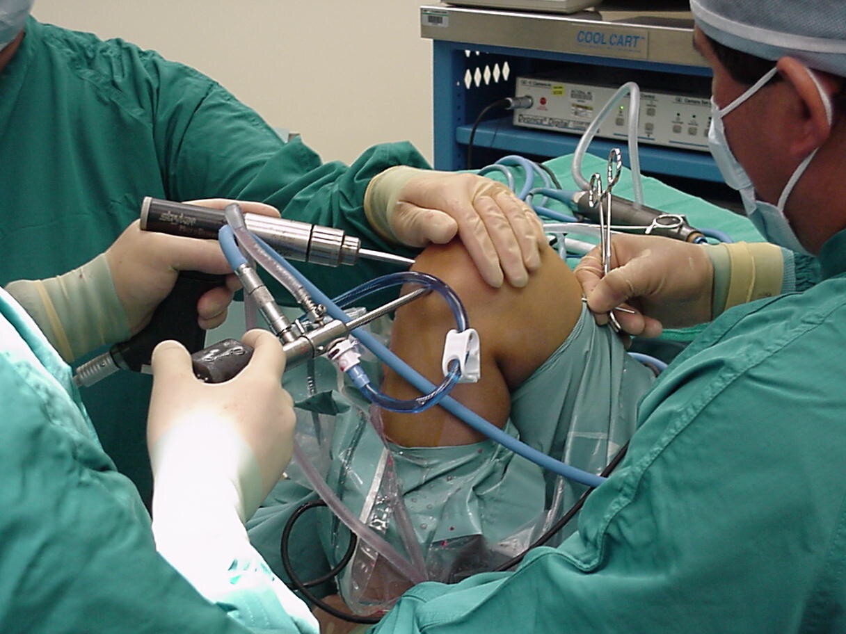 It takes A Village To Rehabilitate An ACL Injury - TRIPP